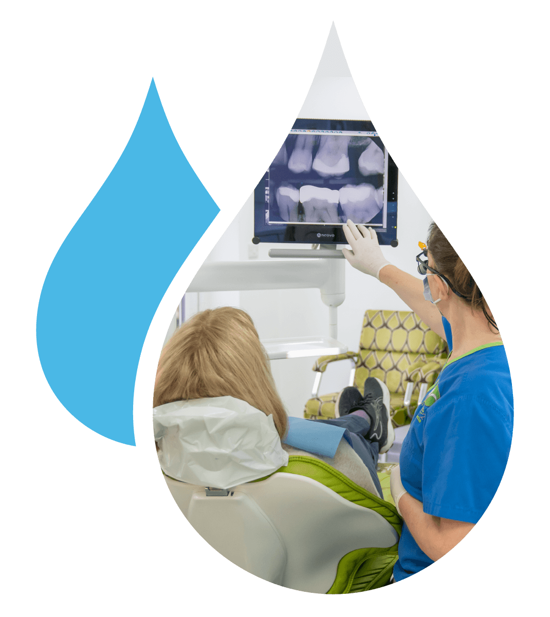 What is Dental Restoration